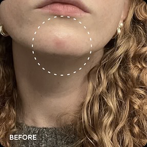 Renewal & Rejuvenation Toner Pads