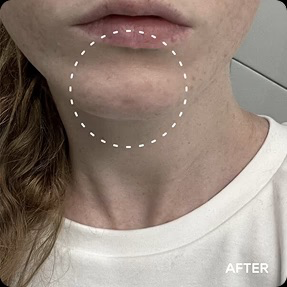 Renewal & Rejuvenation Toner Pads